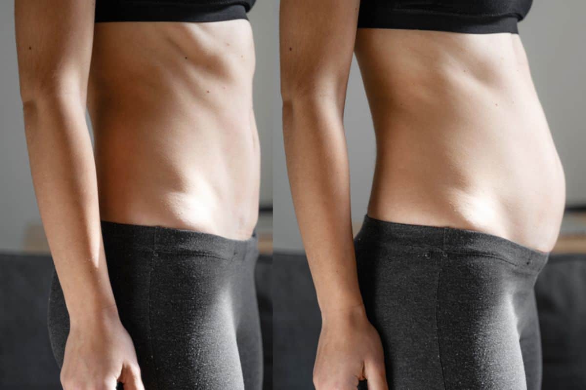 How long does diastasis recti take to improve Port Glasgow?
