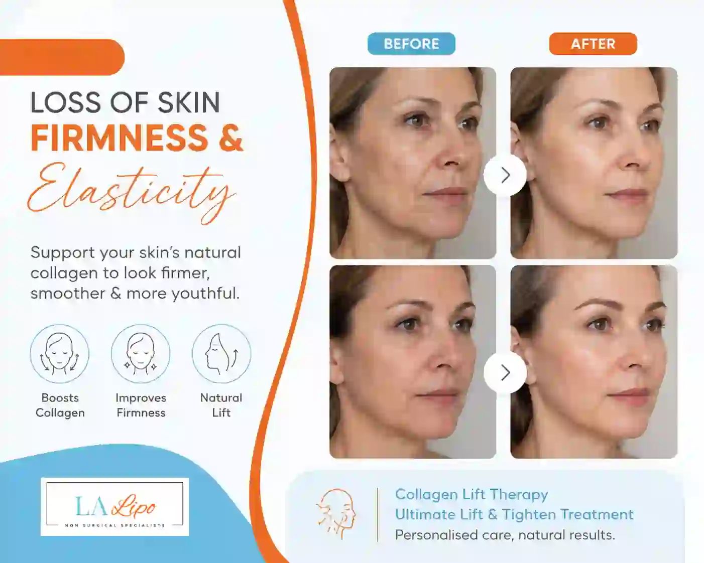 Sign #7: Loss of Skin Firmness and Elasticity Port Glasgow