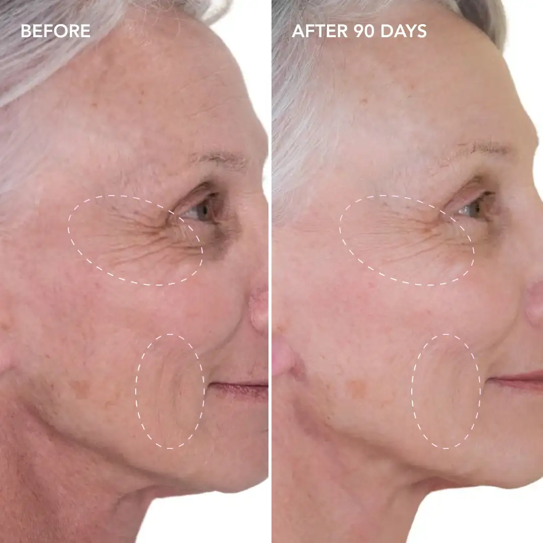 When will you see results Port Glasgow